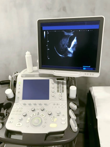 Comprar equipamento de ultrassonografia